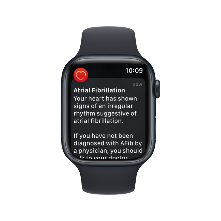 On the Apple's heart rate, you can include heart rate notices that may warn you if your heart beats remains above or below the selected threshold after you have been inactive for 10 minutes. You can also set an irregular heart notification or show the history of atrial fibrillation. (Picture of Vanessa Kission)